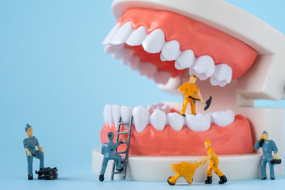 Construction Workers on Teeth